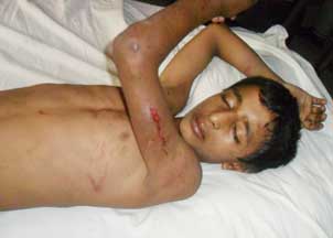 রামগঞ্জে গৃহকর্মীকে পিটিয়ে ও কুপিয়ে নির্মম নির্যাতন॥
নির্যাতনকারীদের গ্রেফতার দাবীতে বাড়ী ঘেরাও